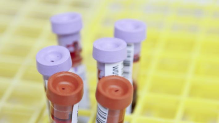 Un don de matériel médical pour trois hôpitaux